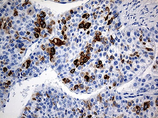 TFF1 / pS2 Antibody (aa25-84, clone OTI1F5)