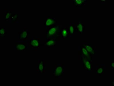 LHX2 Antibody