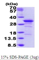 Human WIBG Protein (Recombinant His)