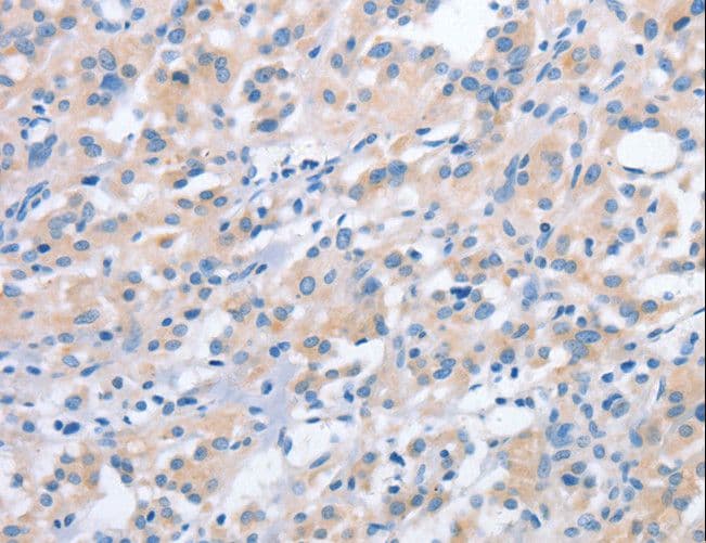 NCAPD2 Antibody