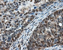 Heat Shock Protein 70 / HSPA1A Antibody (clone OTI1B2)