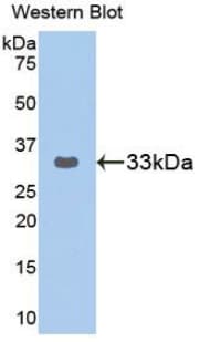GRAP2 / GRID Antibody (aa77-325, HRP)