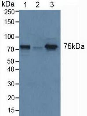 GBA / Glucosidase Beta Acid Antibody (aa117-214, APC, Cy7)