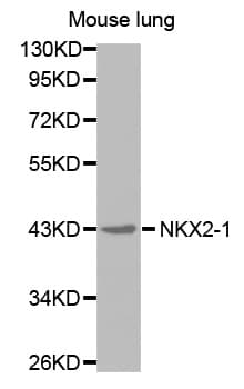 NKX2-1 / Thyroid-Specific TF Antibody