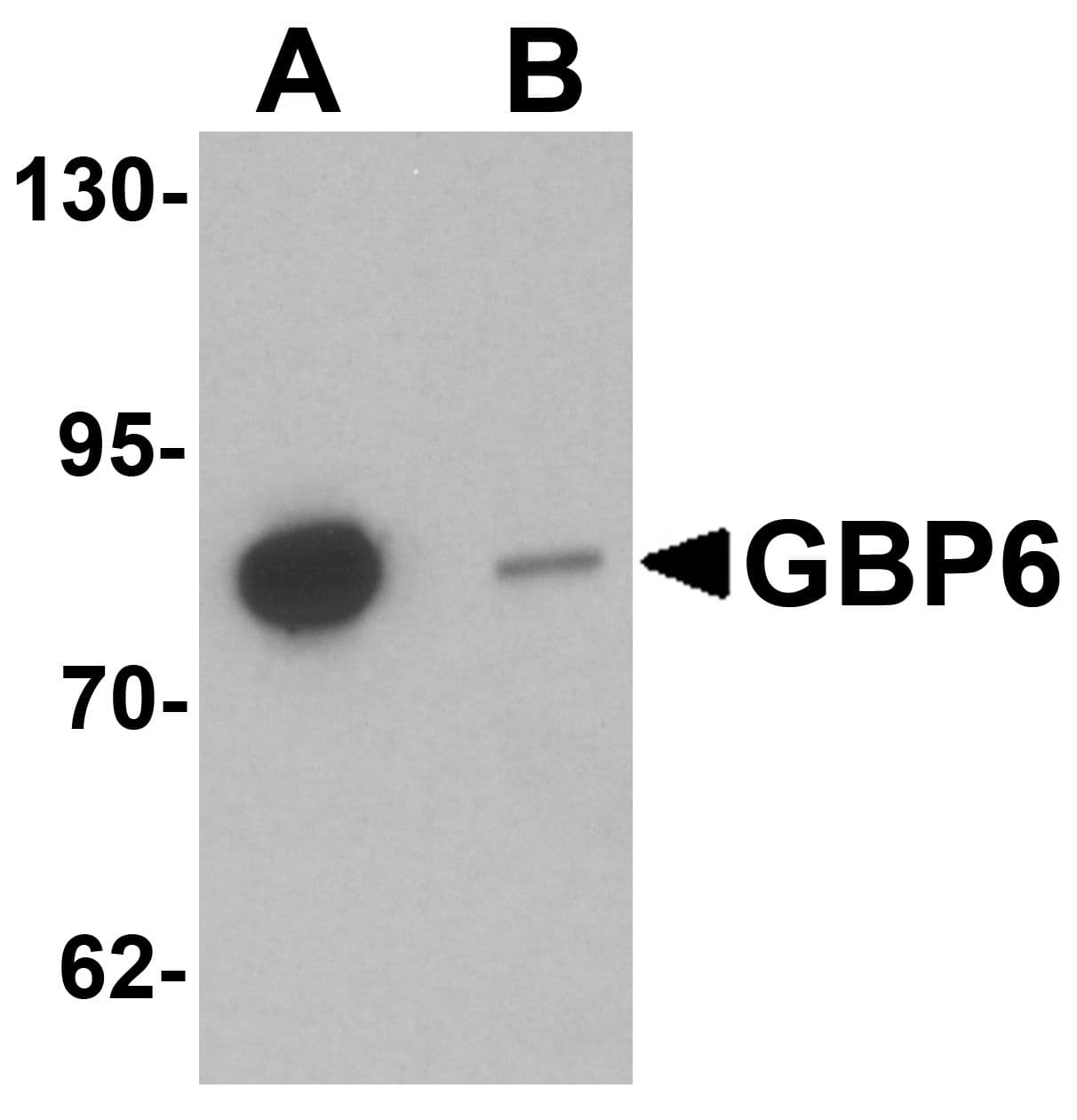 IHC-plus™ Polyclonal Rabbit anti-Human GBP6 Antibody (IHC, IF, WB)