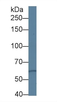 PKD3 / PRKD3 Antibody (aa576-832, Biotin)