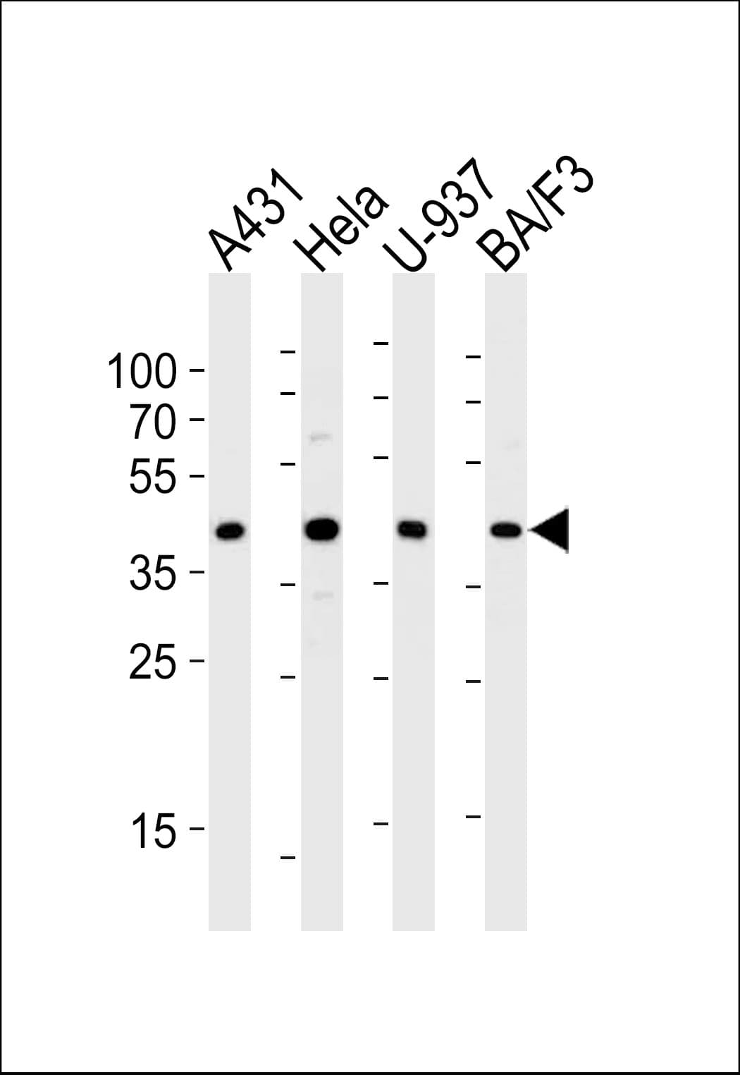 PGK1 / Phosphoglycerate Kinase Antibody (aa305-334)