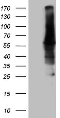 Monoclonal Mouse anti-Human CAMK2B / CaMKII Beta Antibody (clone OTI8D9, Carrier-free, aa311-385, IHC, WB)