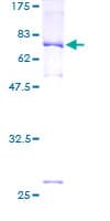 Human PREB Protein (Recombinant GST)