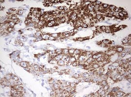 OTC Antibody (aa33-354, clone OTI3A5)
