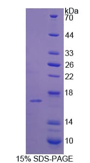 Rat PLA2G2D Protein (Recombinant His)