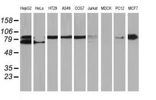 Monoclonal Mouse anti-Human CTNNB1 / Beta Catenin Antibody (clone OTI8B5, IF, WB)