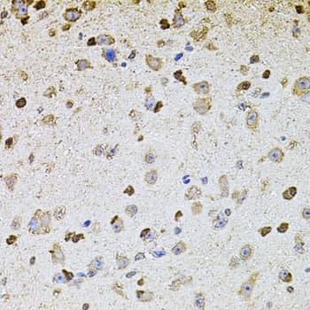 ALDH1A1 / ALDH1 Antibody
