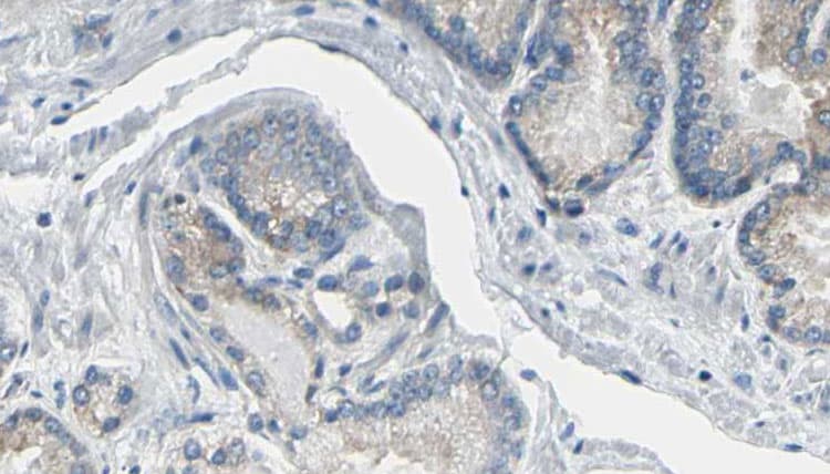 Polyclonal Rabbit anti-Human CDC37 Antibody (IHC, IF, WB)