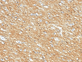 NCAM / CD56 Antibody (clone 56C04, also called 123A8)