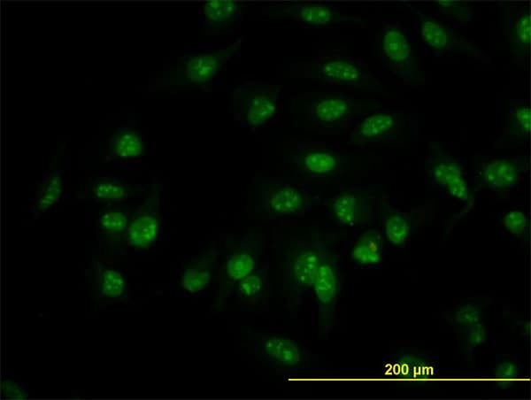 Monoclonal Mouse anti-Human C1D Antibody (clone 6H2, IF, WB)