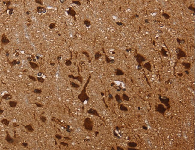 Polyclonal Rabbit anti-Human KARS Antibody (IHC, WB)