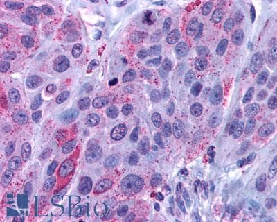 PathPlus™ Polyclonal Rabbit anti-Human HRH1 / Histamine H1 Receptor Antibody (Extracellular Domain, IHC)