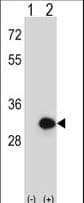 Polyclonal Rabbit anti-Human BPGM Antibody (aa230-259, WB)