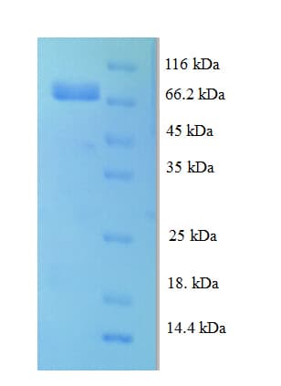 Human LRRC40 Protein (Recombinant His)