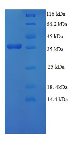 Human GGCT Protein (Recombinant His-SUMO)