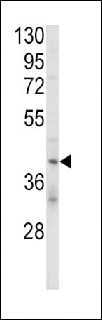 KIR2DL4 Antibody (aa296-323)