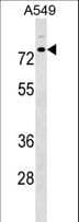 TRIM16 Antibody (aa38-67)