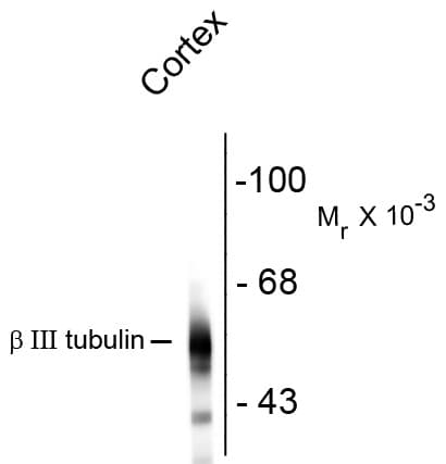 IHC-plus™ Monoclonal Mouse anti-Rat TUBB3 / Tubulin Beta 3 Antibody (IHC, WB)