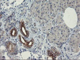 Monoclonal Mouse anti-Human SLA2 / SLAP2 Antibody (clone OTI1E7, IHC, WB)