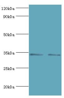 KIR2DS4 Antibody (aa22-245)