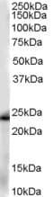 IHC-plus™ GSTP1 / GST Pi Antibody (aa22-33)