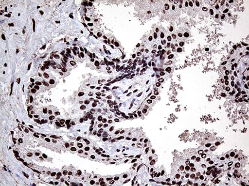 PPP4C Antibody (clone OTI2H8)