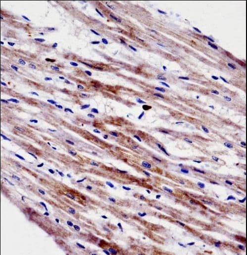 CTF1 / Cardiotrophin-1 Antibody (aa166-194)