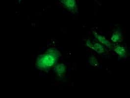 SDS Antibody (clone OTI1C8)