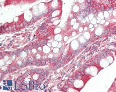IHC-plus™ ITGB1 / Integrin Beta 1 / CD29 Antibody (aa746-795)
