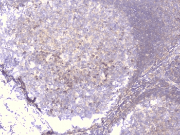 PCDH15 Antibody
