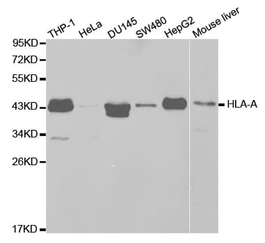 IHC-plus™ Polyclonal Rabbit anti-Human HLA-A Antibody (IHC, IF, WB)