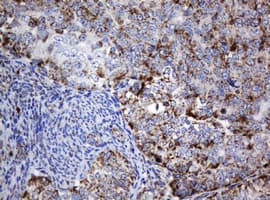 Monoclonal Mouse anti-Human NDUFB10 Antibody (clone OTI2G1, IHC, WB)