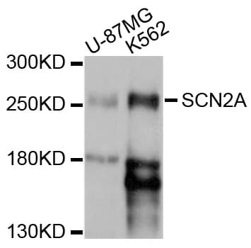 SCN2A / Nav1.2 Antibody