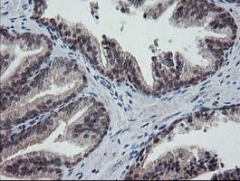 ESRRG / ERR Gamma Antibody (aa24-263, clone OTI1E5)