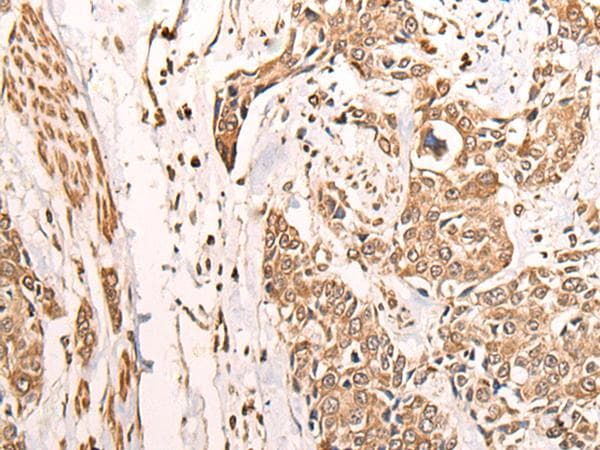 ATAD3A Antibody