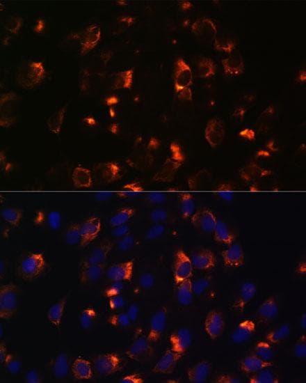 CCDC47 Antibody