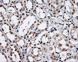DAPK2 / DAP Kinase 2 Antibody (clone OTI1C5, Carrier-free)
