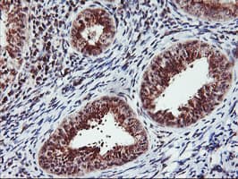 Monoclonal Mouse anti-Human MGLL / Monoacylglycerol Lipase Antibody (clone OTI1B1, IHC, IF, WB)