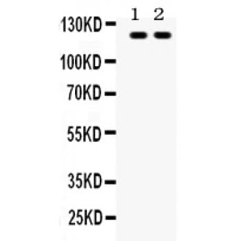 TLR8 Antibody (aa881-907)