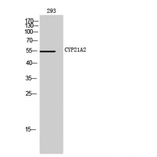 Polyclonal Rabbit anti-Human CYP21A2 Antibody (120-200 aa, Internal, IHC, IF, WB)