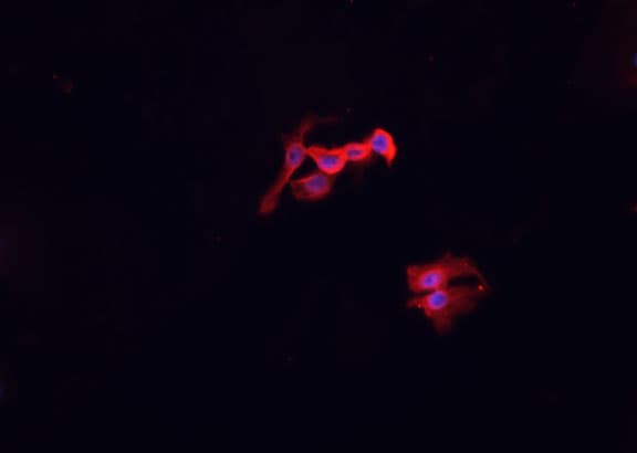 MSR1 / CD204 Antibody