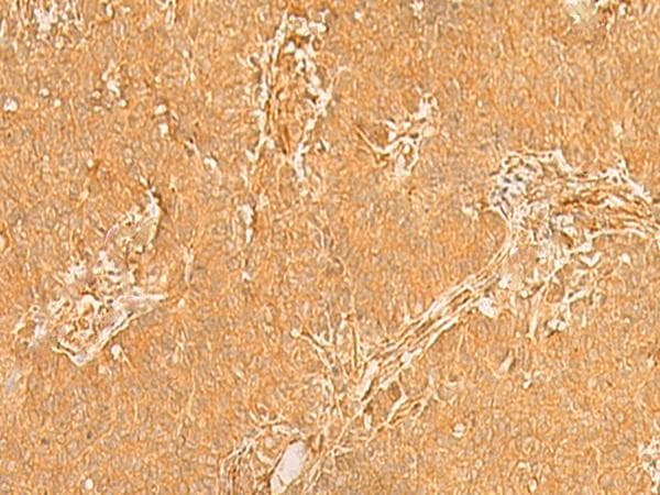 KRT76 / Keratin 76 Antibody