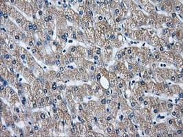 GBE1 Antibody (clone OTI5B7)