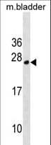 TPD52L1 Antibody (aa43-70)